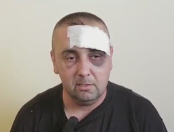 Оцелелият шофьор от касапницата край Микре с покъртителен разказ  (ВИДЕО)