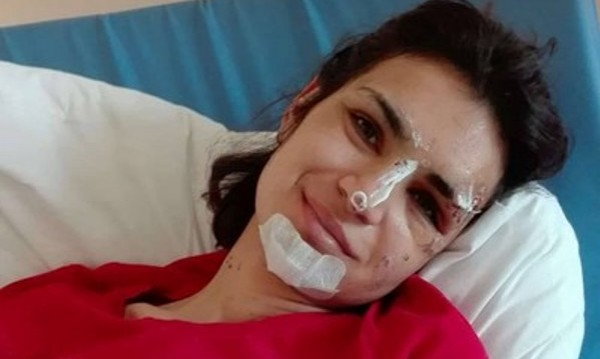 Страшната история на красивата Антония, която реши да се самоубие, но сега е без крака 
