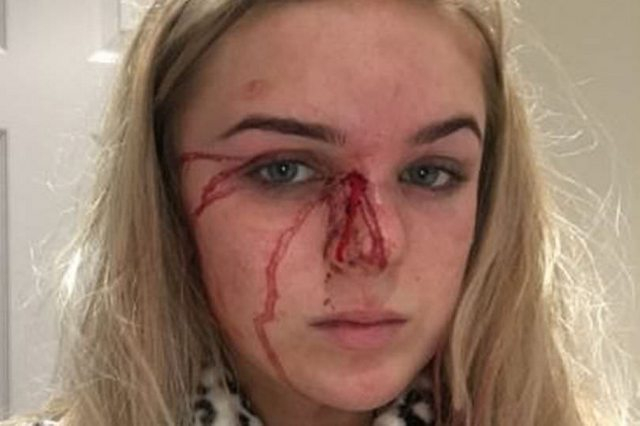 Млада красавица цяла година позволяваше на своя приятел да я пребива и изнасилва, но най-накрая се измъкна с хитрост (СНИМКИ 18+)