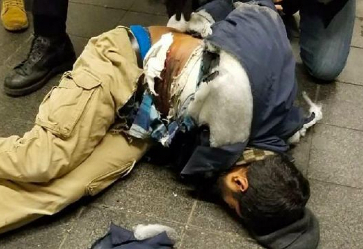 Бомбаджията от Ню Йорк си го получи - кърви в болницата, но вече го обвиниха