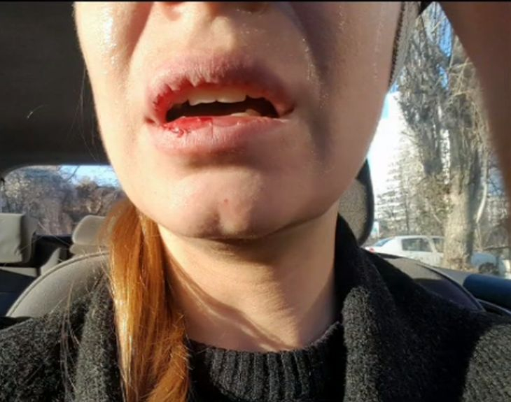 Столичанин размаза лицето на шофьорка с цигански плесник, а пред полицаите излезе с невероятно обяснение! (СНИМКА)