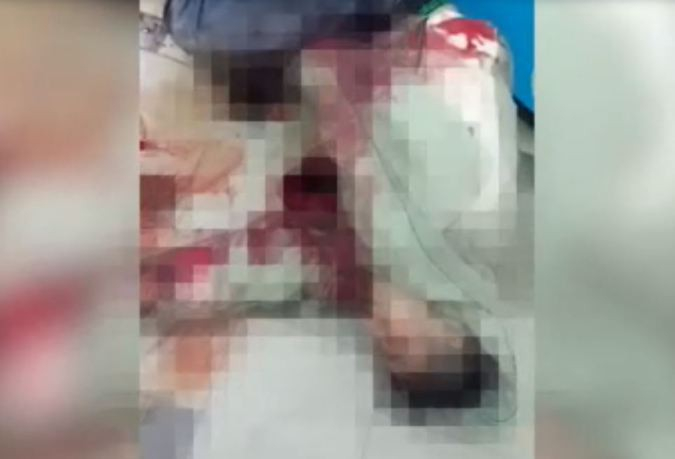 Ужасяващо зверство! Мъж закла приятелката си, след като тя отказа предложението му за женитба (СНИМКИ/ВИДЕО 18+)