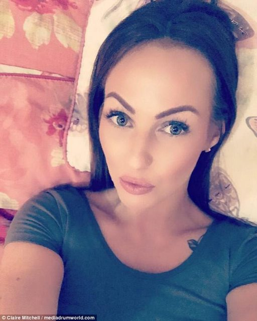 Пълничка медицинска сестра сбъдна мечтата на всеки мъж, стана секс бомба (СНИМКИ)