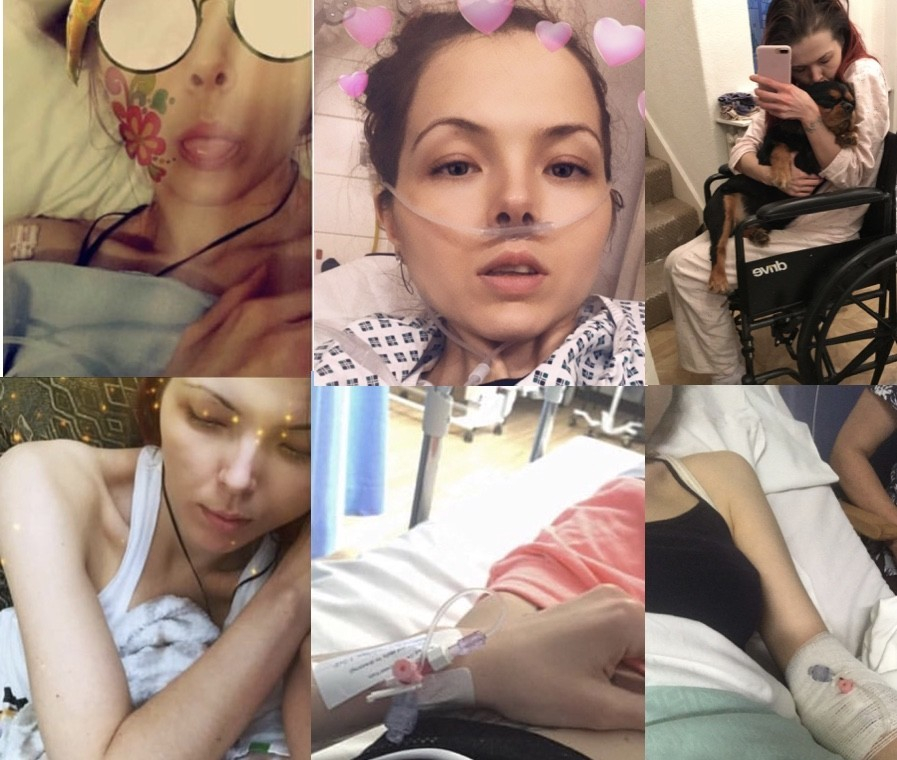Това мило момиче е жив труп с куп болести заради насекомо, което може да ухапе всеки (СНИМКИ/ВИДЕО)