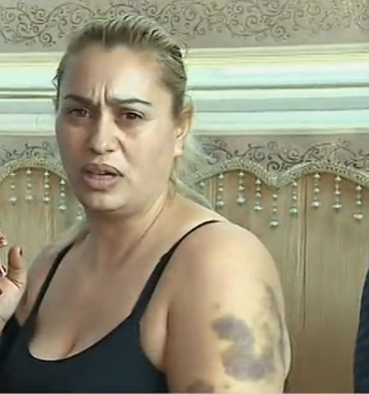 Ромка от Ихтиман се разголи и опищя ефира на Нова, че била бита от полицаи! 