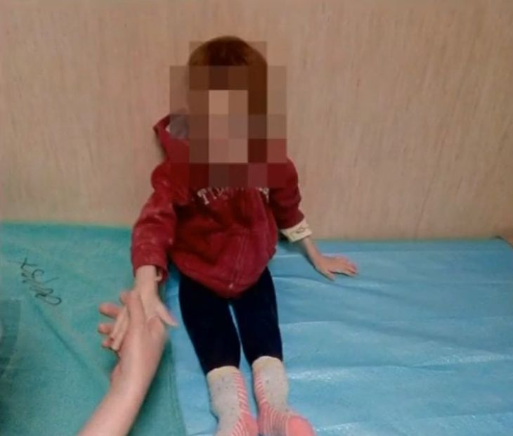 Ужас в Пловдив: Две 3-годишни близначета, мършави като скелети, с рани и синини, приети по спешност в болница, а пияната им майка... (СНИМКИ/ВИДЕО)