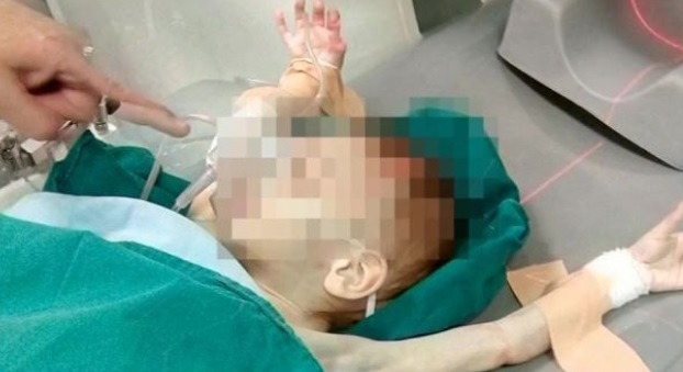 Бабата на мършавите и ранени близначета в Пловдив проговори за мъките им!