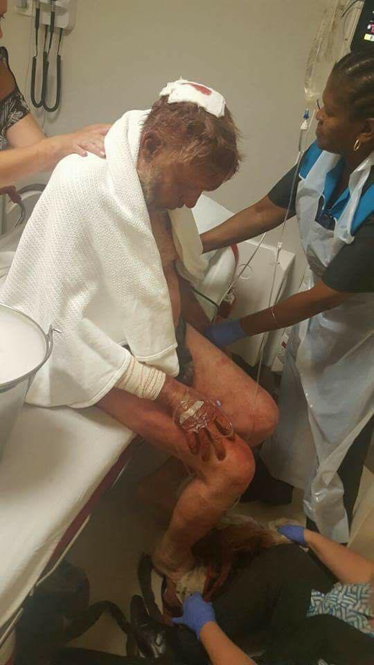 Джамбазки показа кървави СНИМКИ 21+ от геноцида срещу белите фермери в Южна Африка! Това, което написа смрази всички