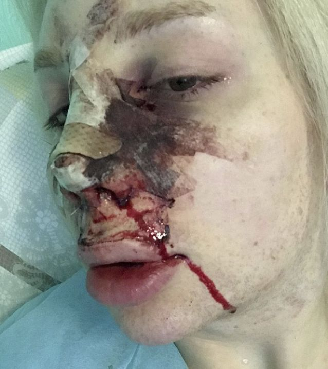 Трансджендър пръсна купища пачки, за да се превърне в пластмасова кукла (СНИМКИ 18+)