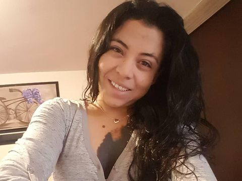 Тя се роди с огромно родилно петно и се срамуваше от себе си, но сега е хит в мрежата (СНИМКИ)