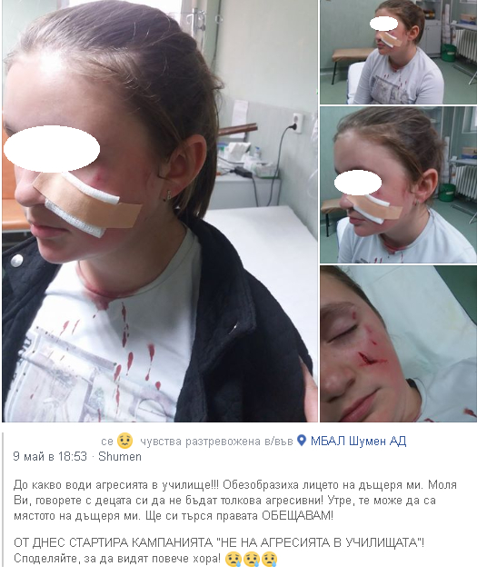 Обезобразиха малко момиченце в шуменско училище! Брутални СНИМКИ (18+)