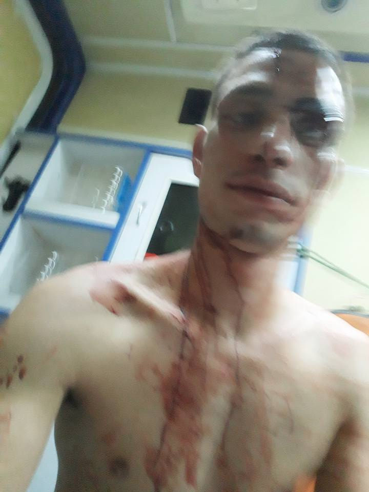 Кръв, бой и свирепа агресия почерниха завършването на Стефан! Пред погледа на приятелката му батки го... (СНИМКИ 18+)