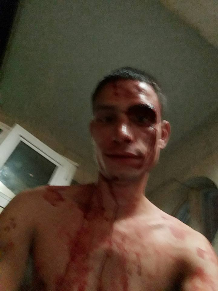 Кръв, бой и свирепа агресия почерниха завършването на Стефан! Пред погледа на приятелката му батки го... (СНИМКИ 18+)