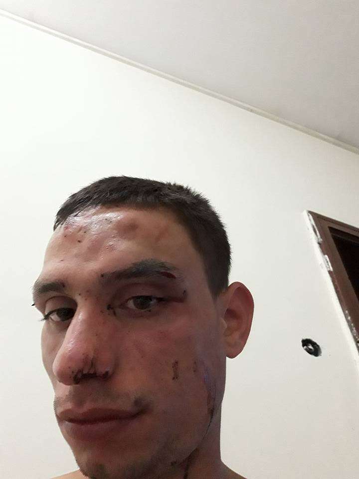 Кръв, бой и свирепа агресия почерниха завършването на Стефан! Пред погледа на приятелката му батки го... (СНИМКИ 18+)