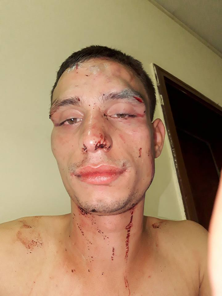 Кръв, бой и свирепа агресия почерниха завършването на Стефан! Пред погледа на приятелката му батки го... (СНИМКИ 18+)