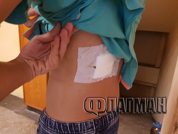 Страшни СНИМКИ на наръгания от агресивен ром 17-годишен Ставри: Крещеше, че ще ме довърши, ако не му дам телефона си!