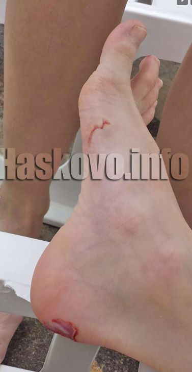 Майка заведе 8-годишния си син на басейн и съжали жестоко (СНИМКИ 18+) 