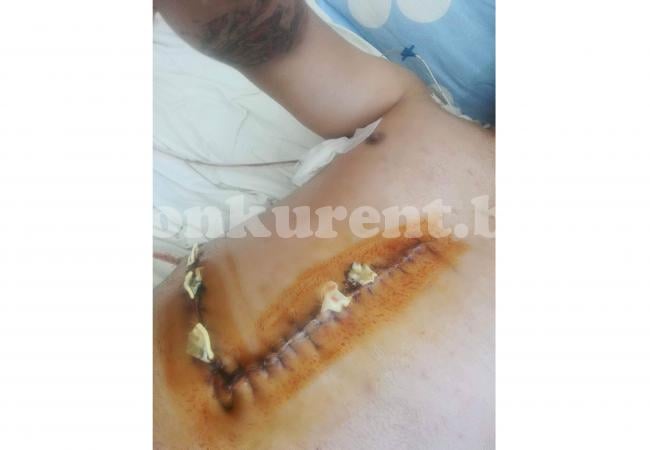 Оцелял при жестока катастрофа с жертва във Враца показа ужасяващи СНИМКИ 18 +