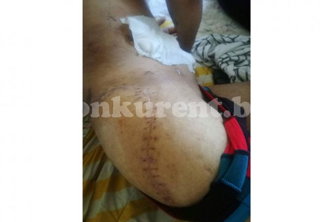 Оцелял при жестока катастрофа с жертва във Враца показа ужасяващи СНИМКИ 18 +