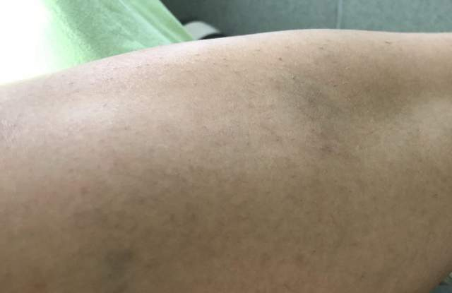Ужас в Пловдивско! Подивелият Ангел смля от бой Пенка - блъска я с вратата на колата! Потресаващи СНИМКИ (18+)