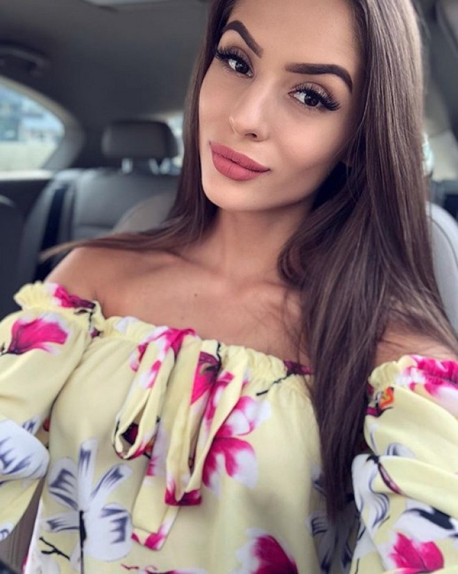 Ослепителна youtube блогърка замина за Турция, но отпуската ѝ там приключи с огнен ад (СНИМКИ/ВИДЕО)