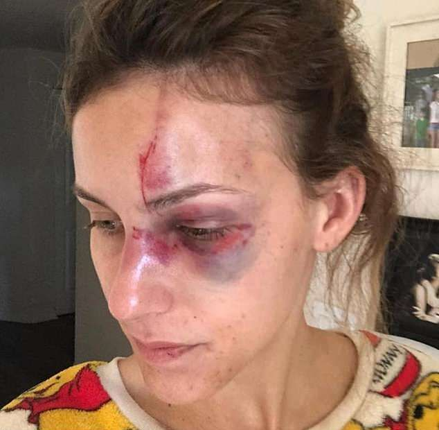 Милионерско синче спука от бой русата си приятелка, показвала си твърде много... (СНИМКИ 18+)