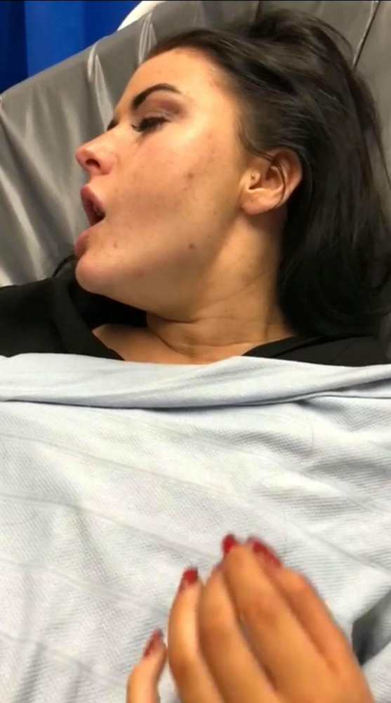 Майка публикува страшна СНИМКА на младата си дъщеря, на която пробутали екстази 