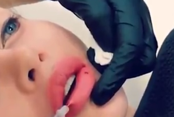 ВИДЕО 18+ показва невероятни мъки, през която преминава моделка, за да заприлича на Барби 