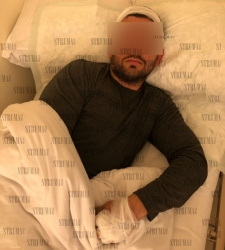 Заради 2 лева пребиха зверски собственик на паркинг в Банско, защото... (СНИМКА)