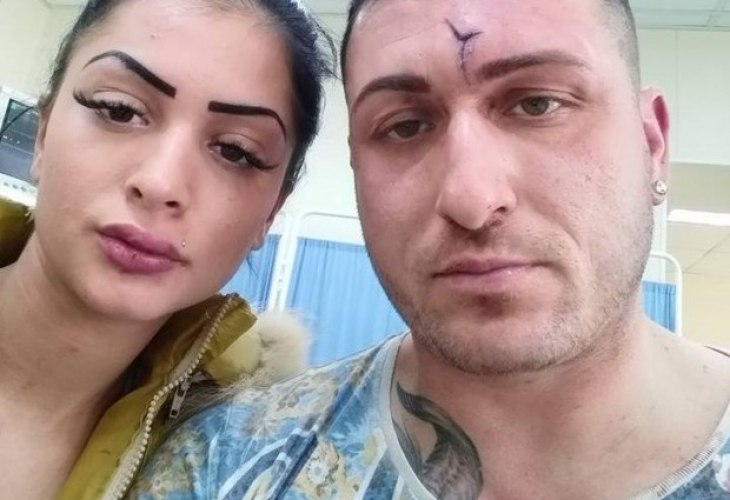 Варненецът и приятелката му, смлени от бой от варненски мутри, изскочили от БМВ, с кървави разкрития за случилото се (ВИДЕО)