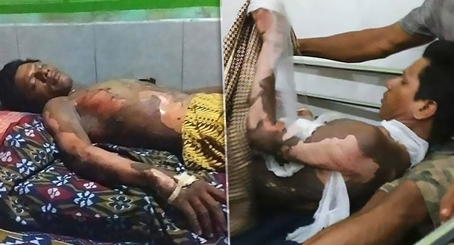 Жена поля мъжа си с бензин и го запали! Причината ще ви смае... (СНИМКИ 18+)