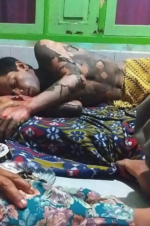 Жена поля мъжа си с бензин и го запали! Причината ще ви смае... (СНИМКИ 18+)