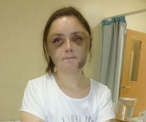 Ужас! Майка и дъщеря решиха да помогнат на инвалид, а бяха пленени, бити и карани да ядат от кофа (СНИМКИ 18+)