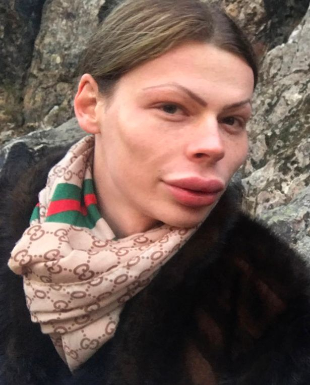Пристрастен към болката и пластичната хирургия джендър от Германия иска да се сдобие с "безизразен" поглед (СНИМКИ)