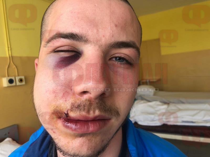 Проговори майката на зверски пребития от мутри ученик