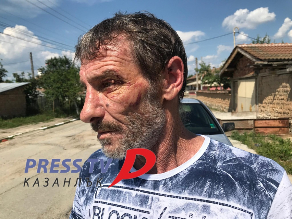 Ексклузивно: Проговори мъжът, пребит от подивели цигани на опашката в селски магазин (ВИДЕО)
