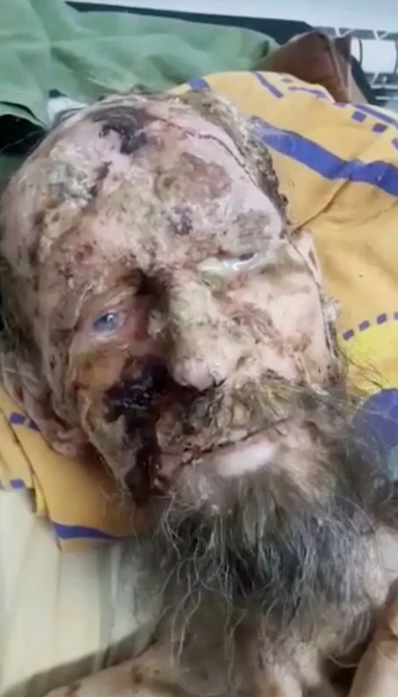Александър гниел нагризан в мечешка бърлога цял месец, но оцелял - СНИМКИ и ВИДЕО (18+) показват ужаса
