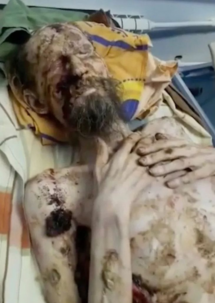Александър гниел нагризан в мечешка бърлога цял месец, но оцелял - СНИМКИ и ВИДЕО (18+) показват ужаса