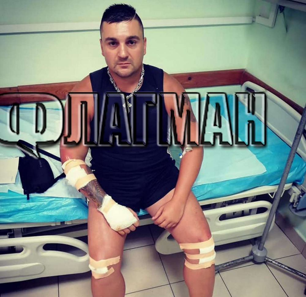 18-годишен циганин едва не уби бургазлия и избяга с колата си (СНИМКИ)