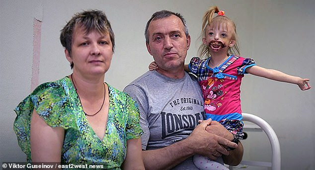 Кръвта ти замръзва, когато видиш лицето на това момиченце-страшилище (СНИМКИ/ВИДЕО)
