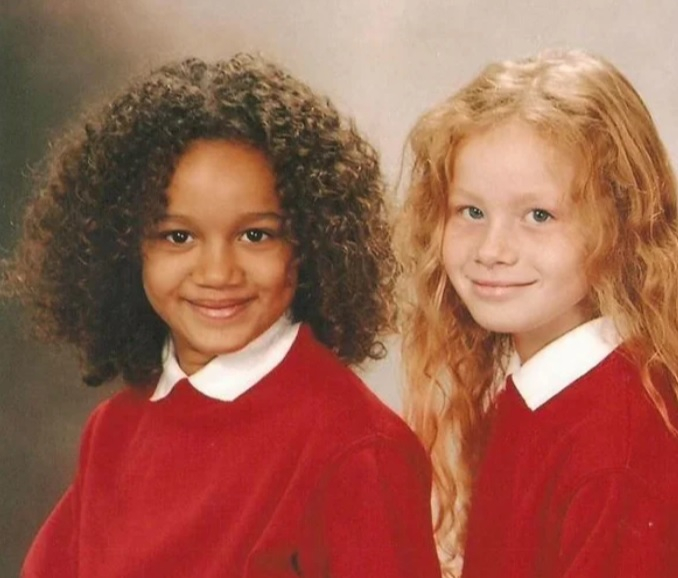 Помните ли близначките с бял и тъмен цвят на кожата? 20 години по-късно те... (СНИМКИ)
