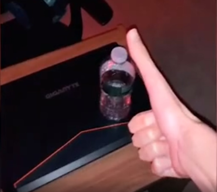 Ненормално дълъг палец прослави американец