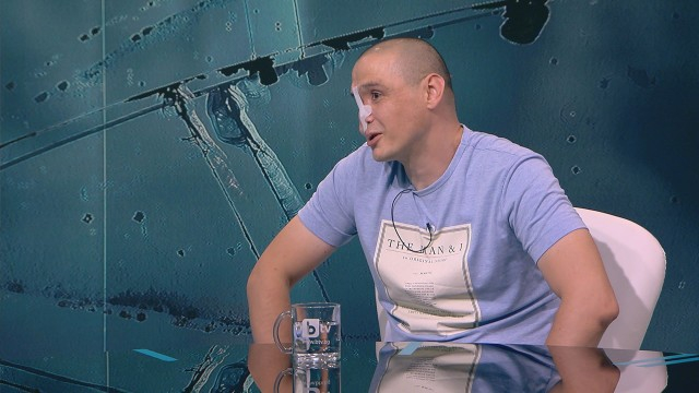 Историята на експолицая Ивайло, останал с половин лице след зверски побой