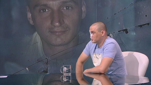 Историята на експолицая Ивайло, останал с половин лице след зверски побой