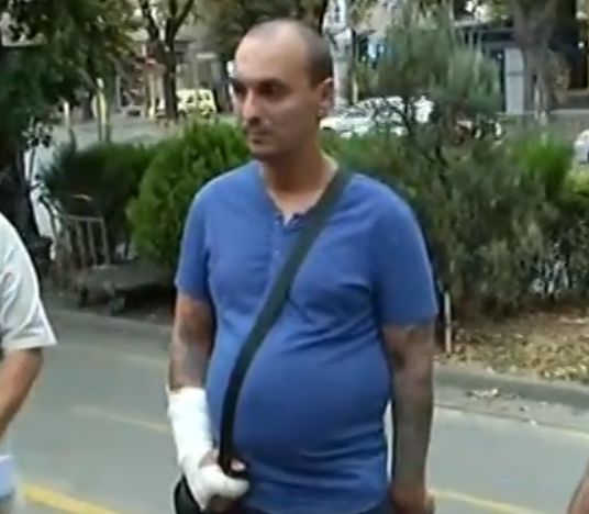 Варненец, нахапан от озверял питбул, разказа за кървавия ужас ВИДЕО