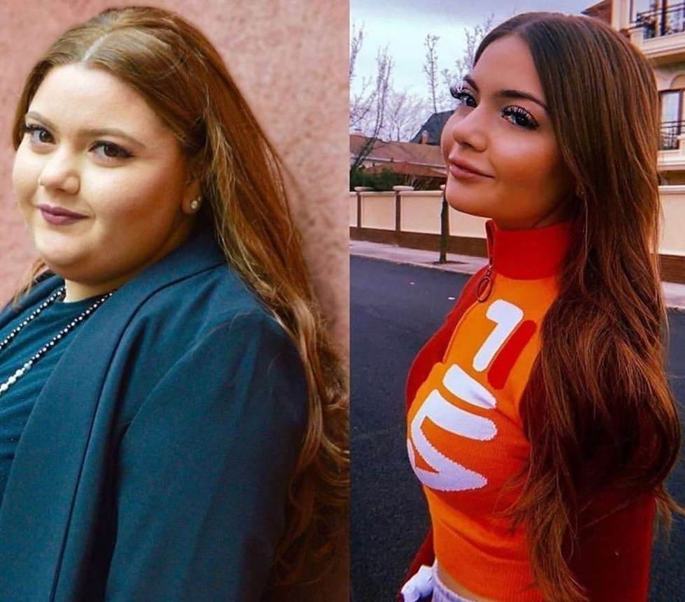 Дебела актриса си отряза стомаха, свали 50 кила и стана уникална секс бомба СНИМКИ