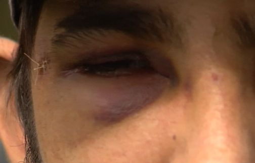Въоръжен апаш ще помни цял живот урока, който му даде бременна в осмия  месец 