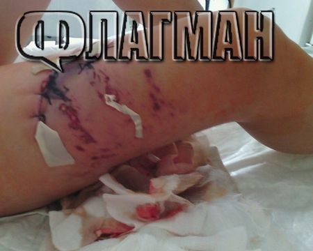 Озверял питбул едва не осакати дете в Поморие, собственикът плаща 18 бона глоба СНИМКИ 18+