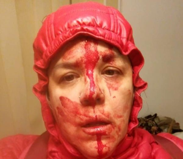 Агресивна мижитурка помля жена, извела кучето си на разходка СНИМКА 18+