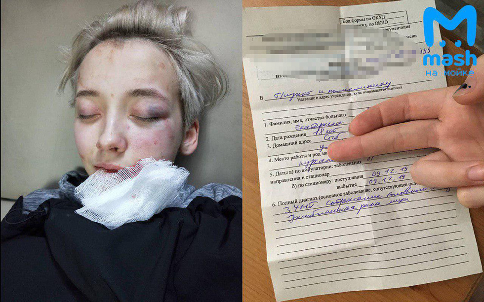 Седем мъже пребиха 18-годишна заради външния й вид ВИДЕО 18+